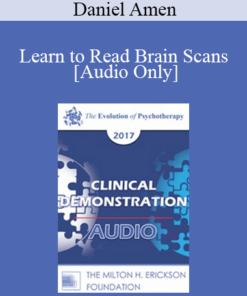 [Audio] EP17 Clinical Demonstration 10 - Learn to Read Brain Scans: 50 cases in 60 Minutes - Daniel Amen