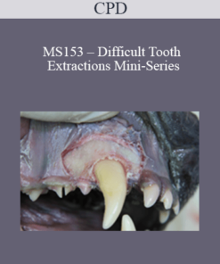 CPD - MS153 – Difficult Tooth Extractions Mini-Series