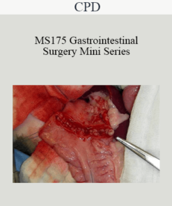 CPD - MS175 Gastrointestinal Surgery Mini Series