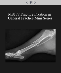 CPD - MS177 Fracture Fixation in General Practice Mini Series